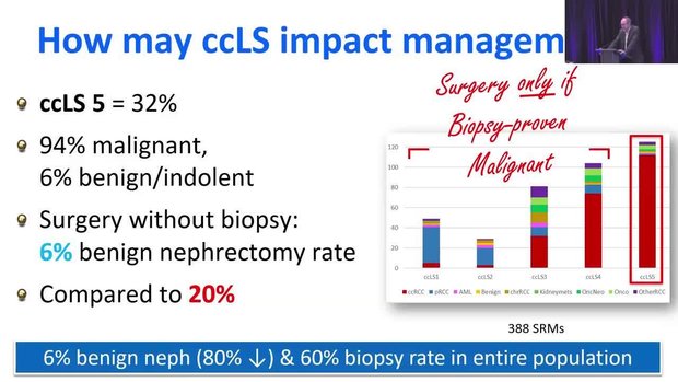 Managing Renal Masses With the Clear Cell Likelihood Score (ccLS) | Vumedi