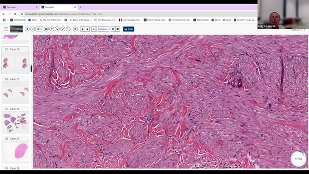Cockerell Dermatopathology | Vumedi