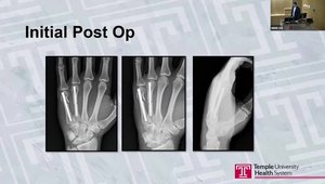 Case Presentation: 20 yo Male with a Rotational Deformity of Small ...