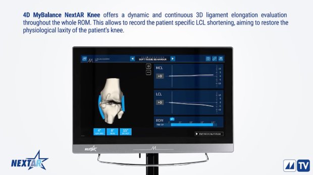 NextAR Knee: Refined Ligament Balancing Assessment with 4D Balancing ...
