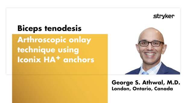 Biceps Tenodesis Arthroscopic Onlay Technique Using All-Suture Anchors ...