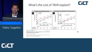 SAVR vs. TAVR: Strategies for Lifelong Management | Vumedi