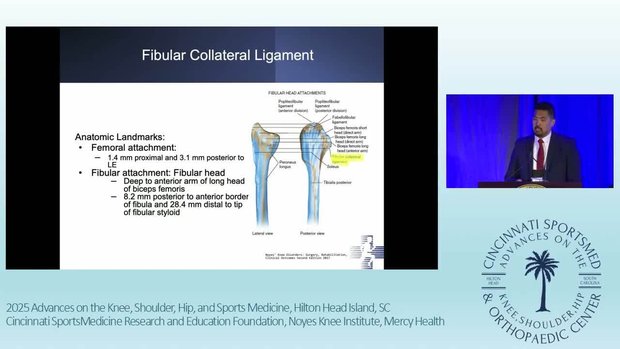 The Key to the Knee: Anatomy of the Lateral and Posterolateral Knee ...