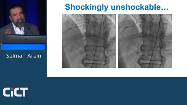 Calcium Management: My Choice is Always Dictated by Anatomy! Coronary ...
