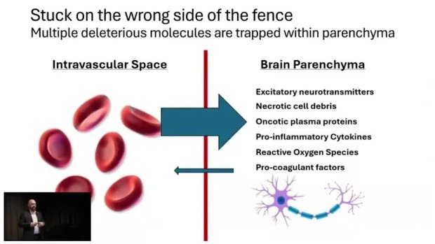 BBB as a Therapeutic Target in Neuro-Trauma | Vumedi