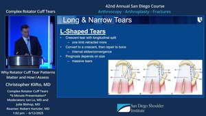 Why Rotator Cuff Tear Patterns Matter and How I Assess | Vumedi