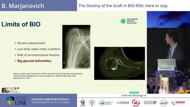 Rome Revision Shoulder Arthroplasty | Vumedi