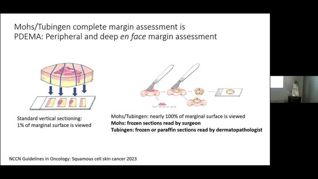Managing High-Risk Squamous Cell Carcinoma (SCC) and Its Precursors ...