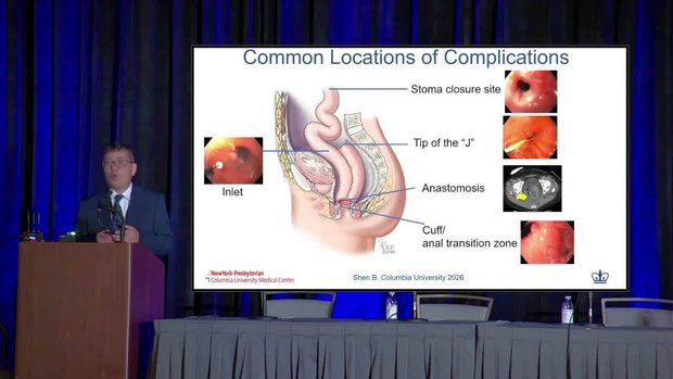 Evaluation and Management of Pouch Disorders | Vumedi