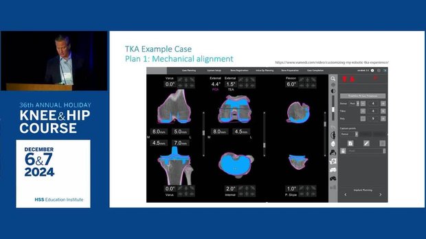 Image Based Robotic TKA | Vumedi