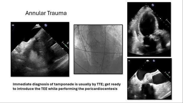 Cleveland Clinic Heart, Vascular and Thoracic Institute | Vumedi