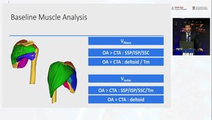 Impact of Rotator Cuff Muscle Volume on Functional Outcomes Following ...