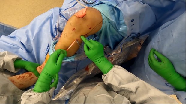 bpc 157 multiple sclerosis Orthopedic Use of BPC-157