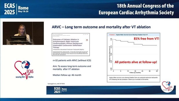 VT Ablation in Rare Variants like ARVC, Non-Compaction and ...