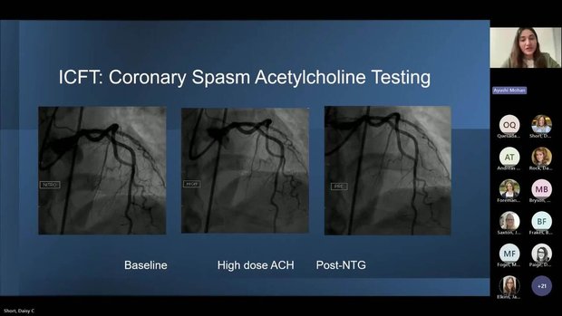Coronary Microvascular & Vasomotor Dysfunction (CMDV) - Case Reviews ...
