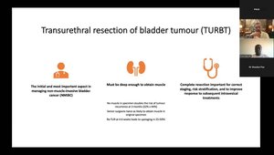 TURBT - Piecemeal, En Bloc, When & How | Vumedi