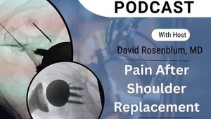 Chronic Pain After Shoulder Joint Replacement: RFA Revisited | Vumedi