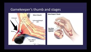 Imaging of the Thumb | Vumedi