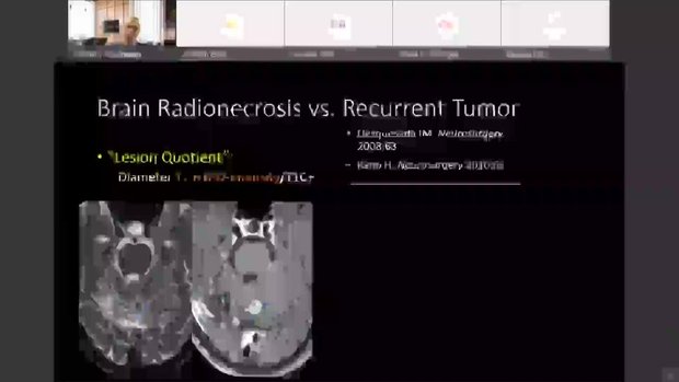 Advanced Imaging in Brain Metastases: Multimodal Techniques and ...
