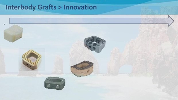Multilevel ACDF Outcomes: Can Segmental Plating and Implant Design ...