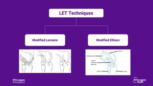 Lateral Extra-Articular Tenodesis via the Modified Ellison Technique ...