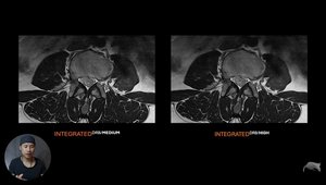 MRI Deep Resolve Boost: Spine | Vumedi