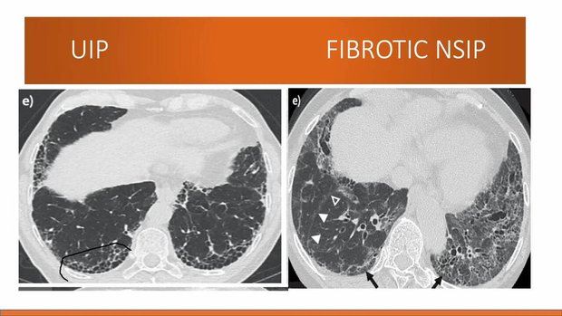 Pulmonology Read Aloud | Vumedi