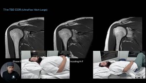 MRI Shoulder: Patient Positioning | Vumedi