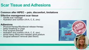 Navigating Recovery After HIPEC and Cytoreductive Surgery in Appendix ...