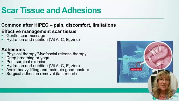 Navigating Recovery After HIPEC and Cytoreductive Surgery in Appendix ...