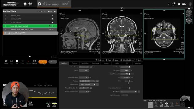 MRI: Inner Ear Imaging | Vumedi