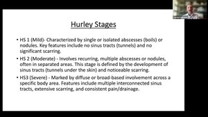 Hidradenitis Suppurativa Diagnosis and Severity Staging: in Clinical ...