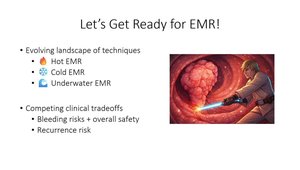 Tackling Large Polyps in Everyday Endoscopy | Vumedi