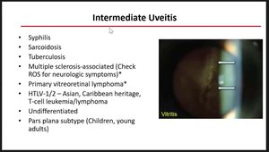 Uveitis Diagnosis and Management: Imaging, AI Classification, and ...