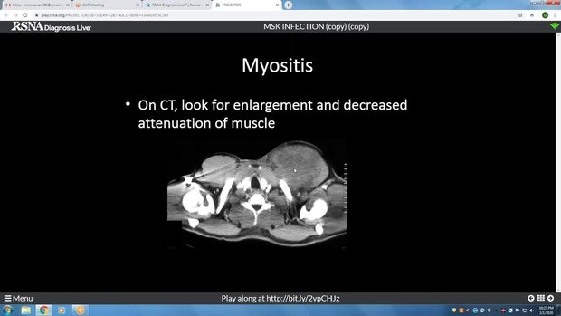 MSK Infection Imaging: CT and Ultrasound Findings in Cellulitis ...
