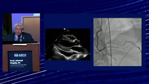 Complex PCI in High-Risk Patients: Lessons in Timing, Thrombus ...