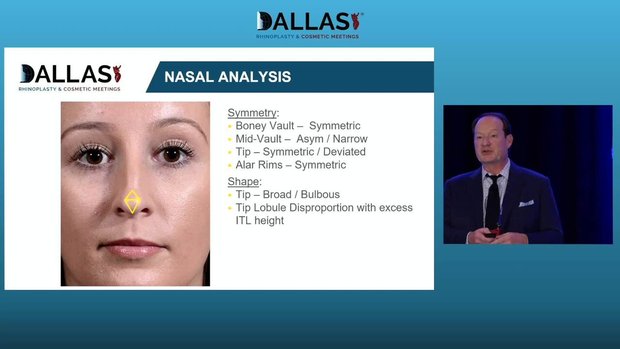 Nasal Analysis – Key to Rhinoplasty Success | Vumedi