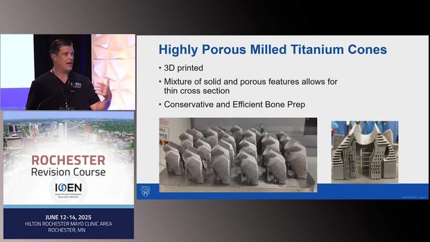 Porous Titanium Cones With a Milled System in rTKA | Vumedi