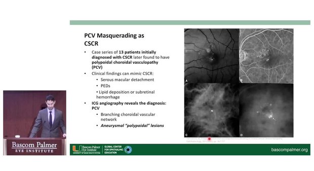 Central Serous Chorioretinopathy: Diagnosis, Imaging, and Management ...