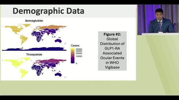 GLP-1Associated Optic Nerve and Retinal Adverse Events Across 180  Countries: Population-Based Observational Study